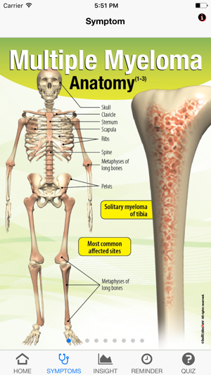 Signs & Symptoms Multiple Myeloma(圖2)-速報App