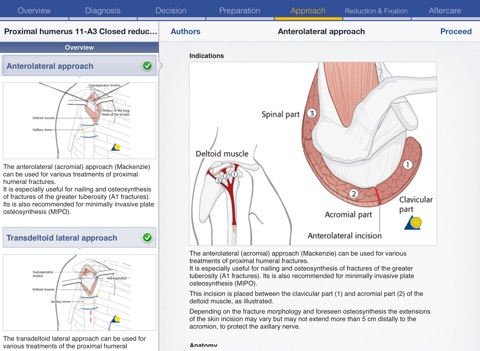 AO Surgery Reference HD screenshot 4