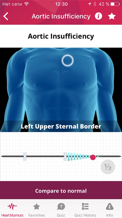 Heart Murmur Pro - The Heart Sound Database