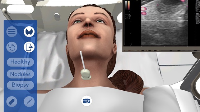 USCAP Thyroid Biopsy Sim(圖3)-速報App