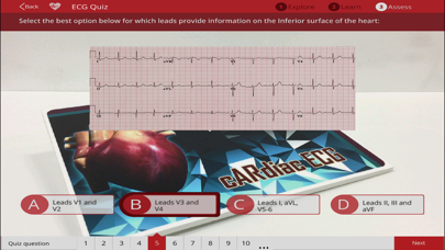 How to cancel & delete cARdiac ECG from iphone & ipad 4