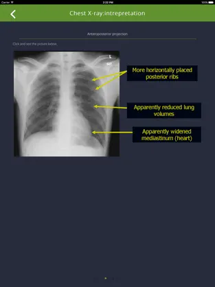 Screenshot 3 Chest Radiographs iphone