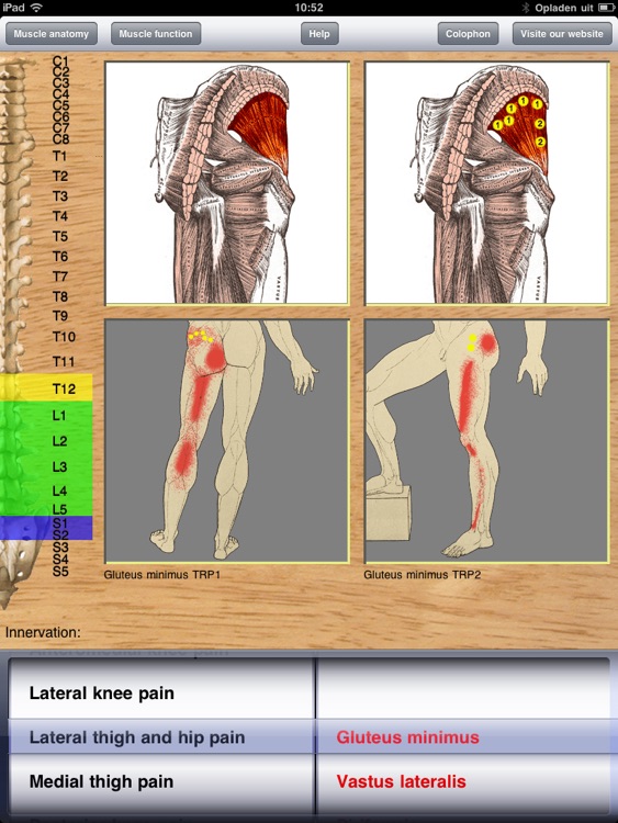 Dry Needling