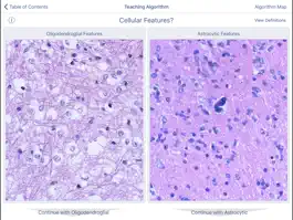 Game screenshot Johns Hopkins Atlas of Surgical Neuropathology hack