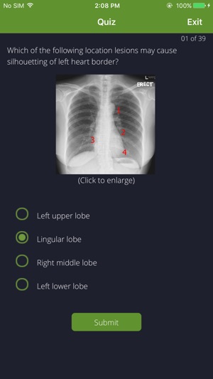 Chest Radiographs(圖5)-速報App