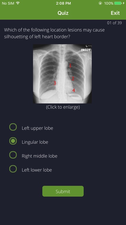 Chest Radiographs screenshot-4