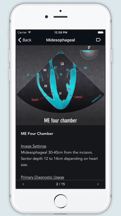 ECHO Views - Transesophageal Echocardiography