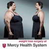Mercy Bariatrics Weightloss Surgery