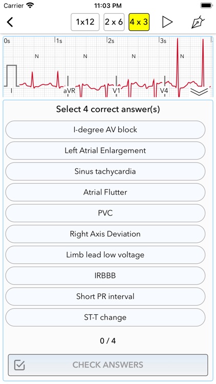 ECG Test for Doctors screenshot-5