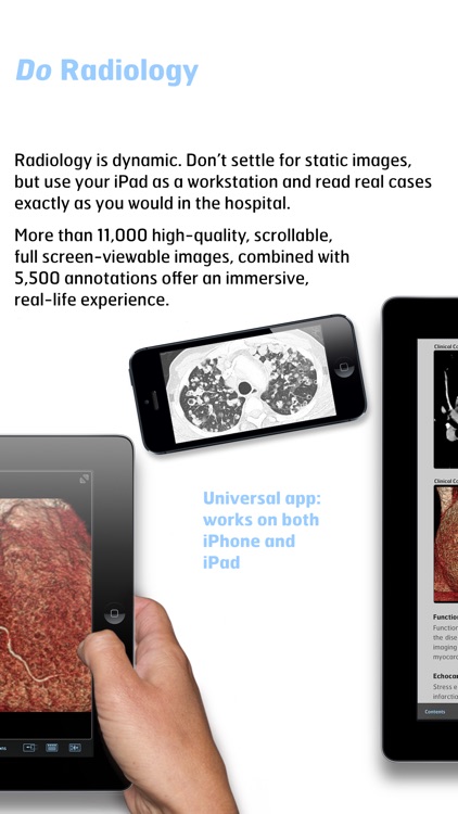 Radiology - Fundamentals of Thoracic Imaging