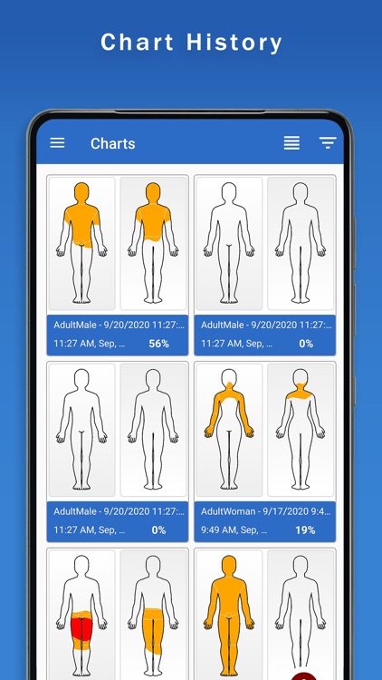 Surface Burn Calculator