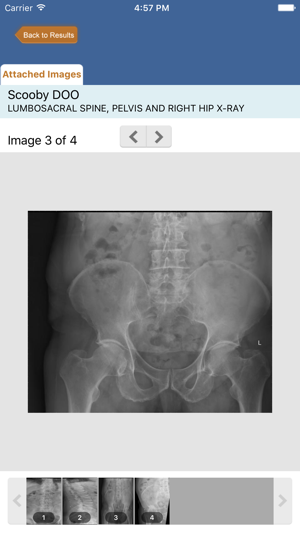 Medinexus Nepean Imaging Results(圖5)-速報App