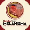 HemOnc Today Melanoma