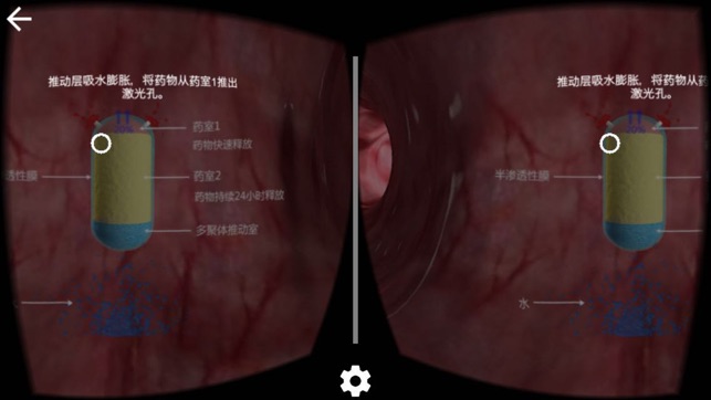 VR视频(医文立德)(圖3)-速報App