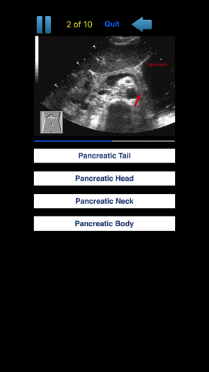 Sono Quiz Abdominal(圖3)-速報App