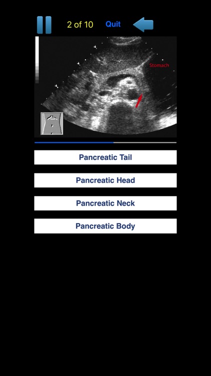 Sono Quiz Abdominal