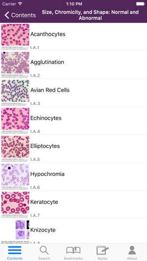 Lichtman's Atlas of Hematology(圖3)-速報App