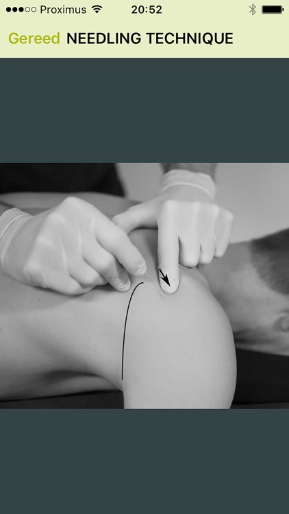Dry Needling Guide screenshot-3