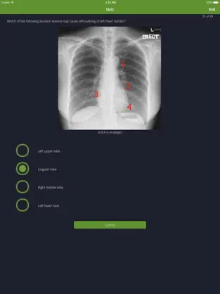 Screenshot 5 Chest Radiographs iphone