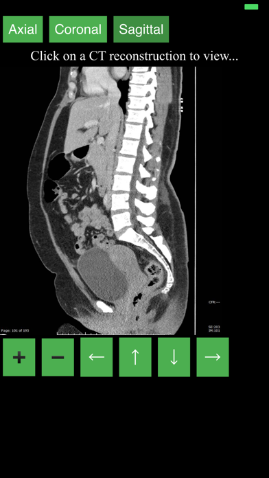 How to cancel & delete CT Abdomen Pelvis from iphone & ipad 3