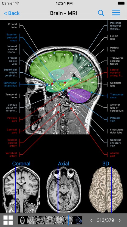 IMAIOS e-Anatomy