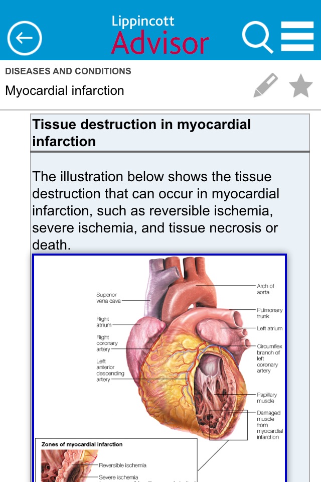 Lippincott Nursing Advisor screenshot 2