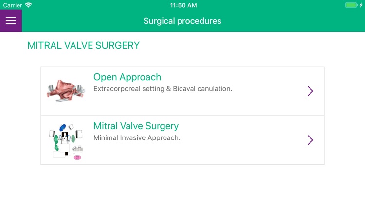 Cardiac Surgery Basics