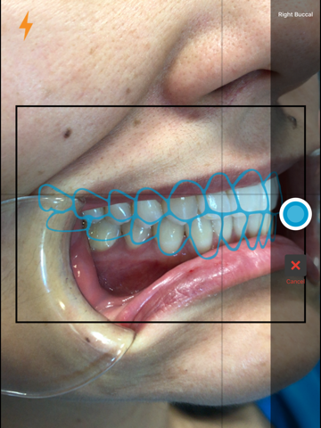 Invisalign Photo Uploader screenshot 3