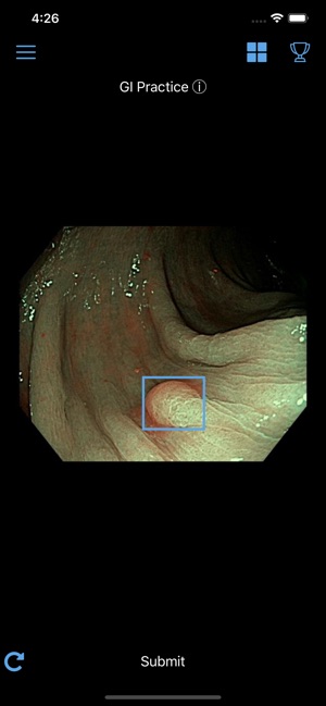 DiagnosUs(圖3)-速報App