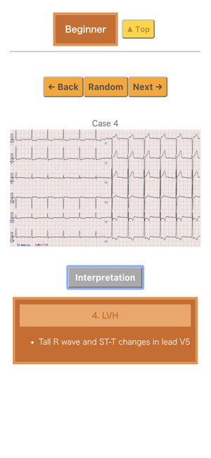 Pocket ECG(圖2)-速報App