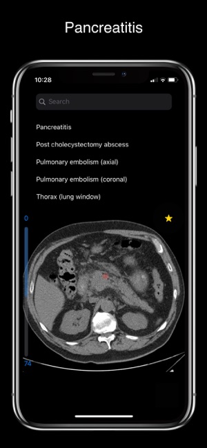 MAD Radiology(圖3)-速報App