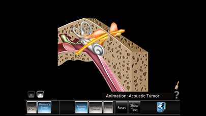 How to cancel & delete Ear Disorders: Inner from iphone & ipad 4