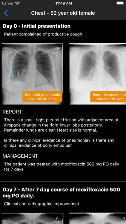 Normal X-Rays and Real Cases screenshot-3