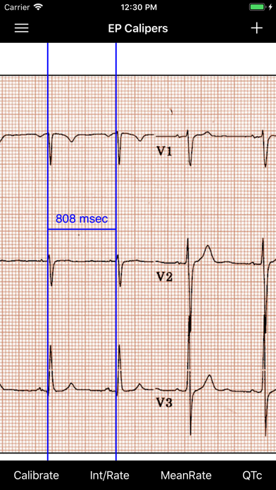 EP Calipers Screenshot 1