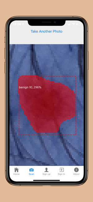 DermoScanner(圖8)-速報App