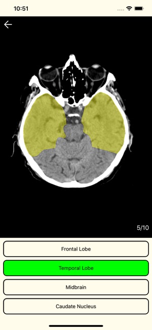 RadAnatomy(圖5)-速報App