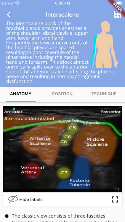 Regional Anesthesia Reference