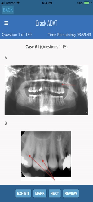 ADAT Advanced Dental Admission