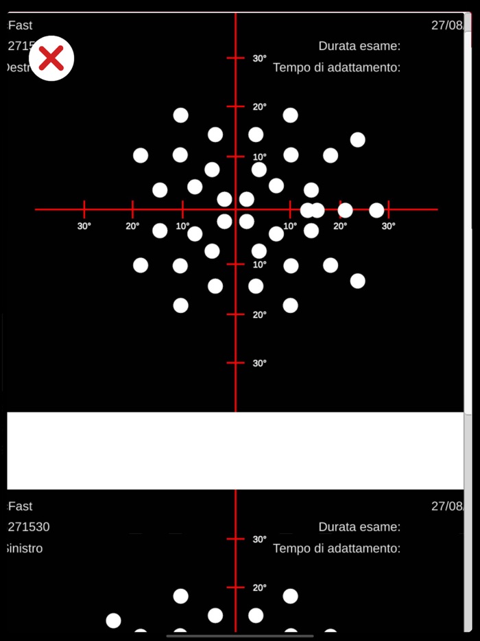 MyVisualField Test