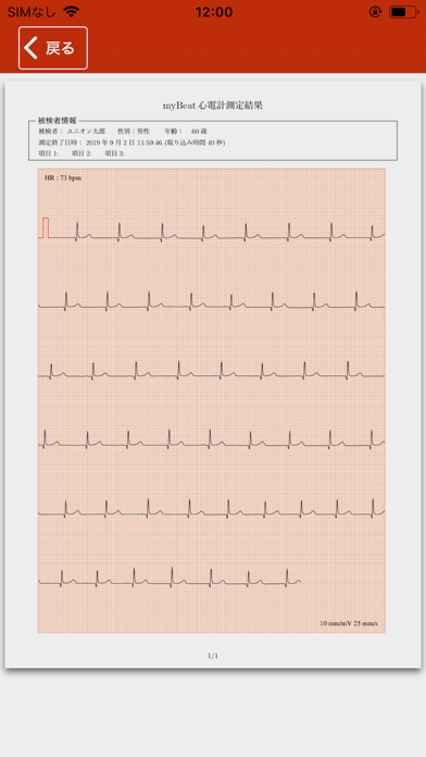 myBeat 心電計 screenshot1