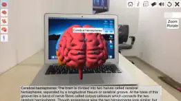 ar human brain iphone screenshot 3