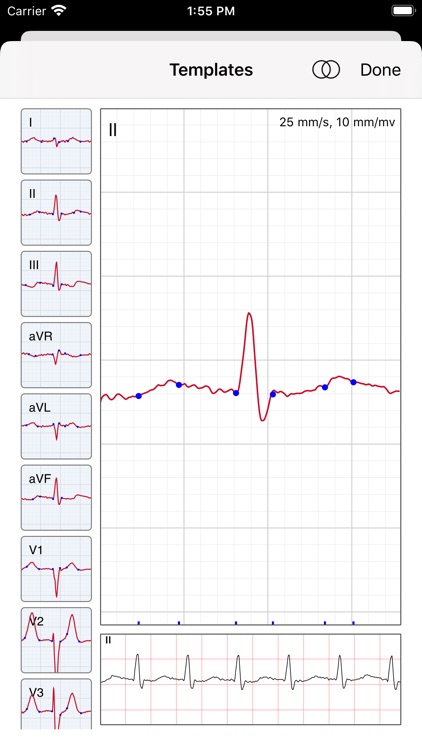 ECG / EKG screenshot-5
