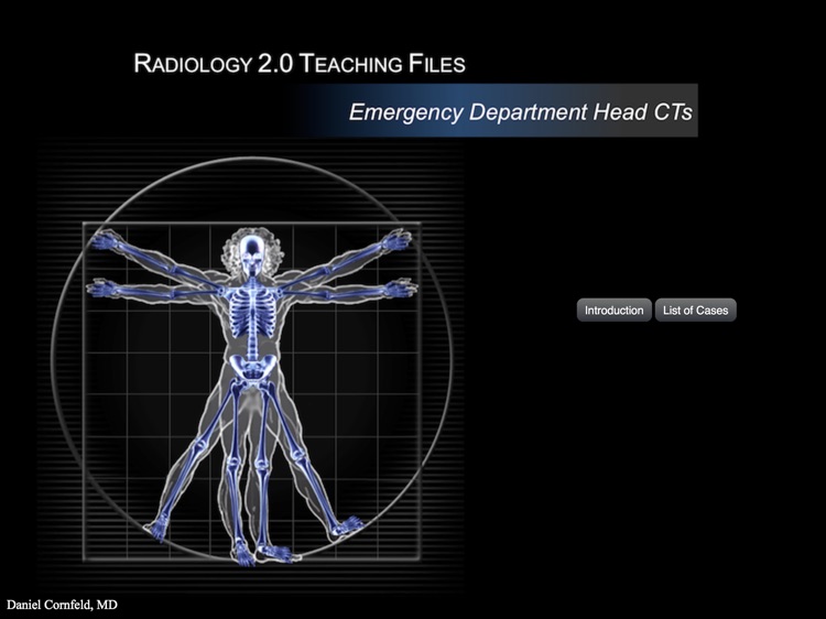 Radiology 2.0: Head CTs