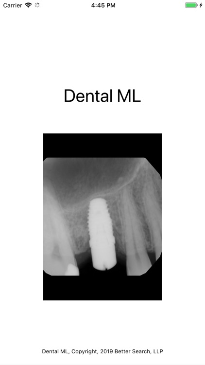 Dental ML