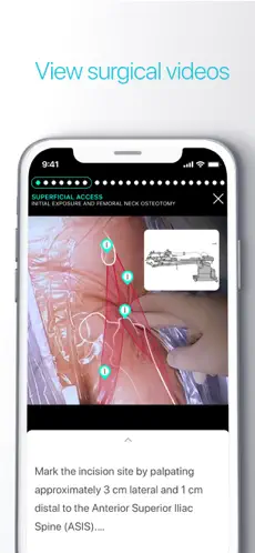 Captura 6 Touch Surgery: Surgical Videos iphone