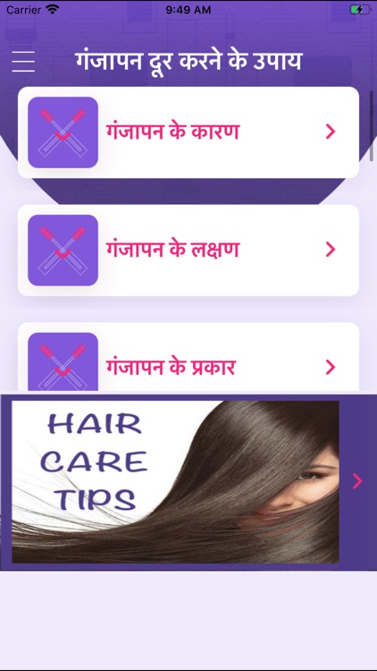 Baldness Hair Loss Tips Hindi