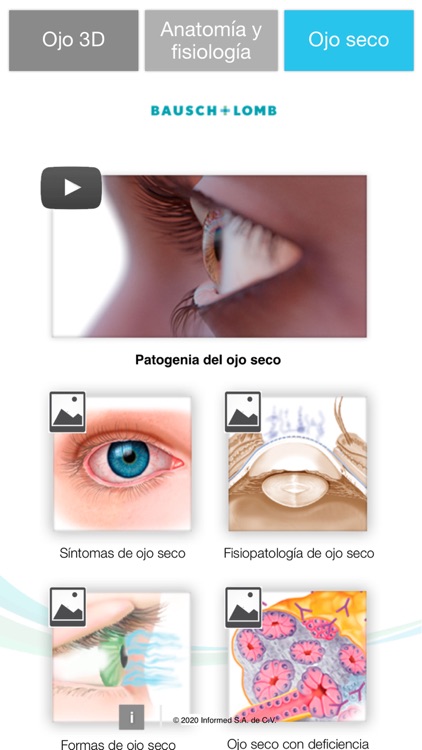 Oftalmología 3D - Ojo Seco screenshot-3