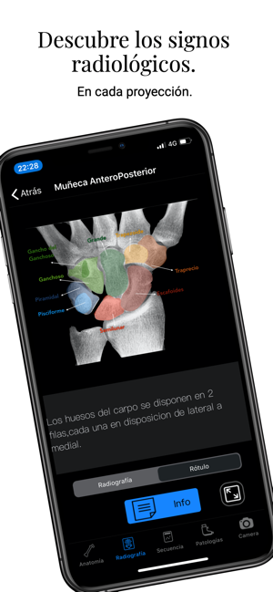 XRay Assistant(圖3)-速報App