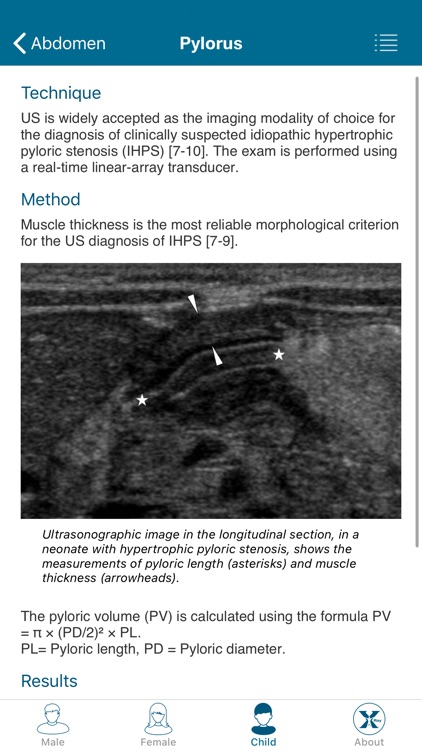Radiology Measurements screenshot-6