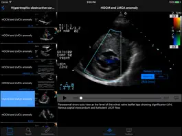 Game screenshot CARDIO3®Echocardiography HD apk